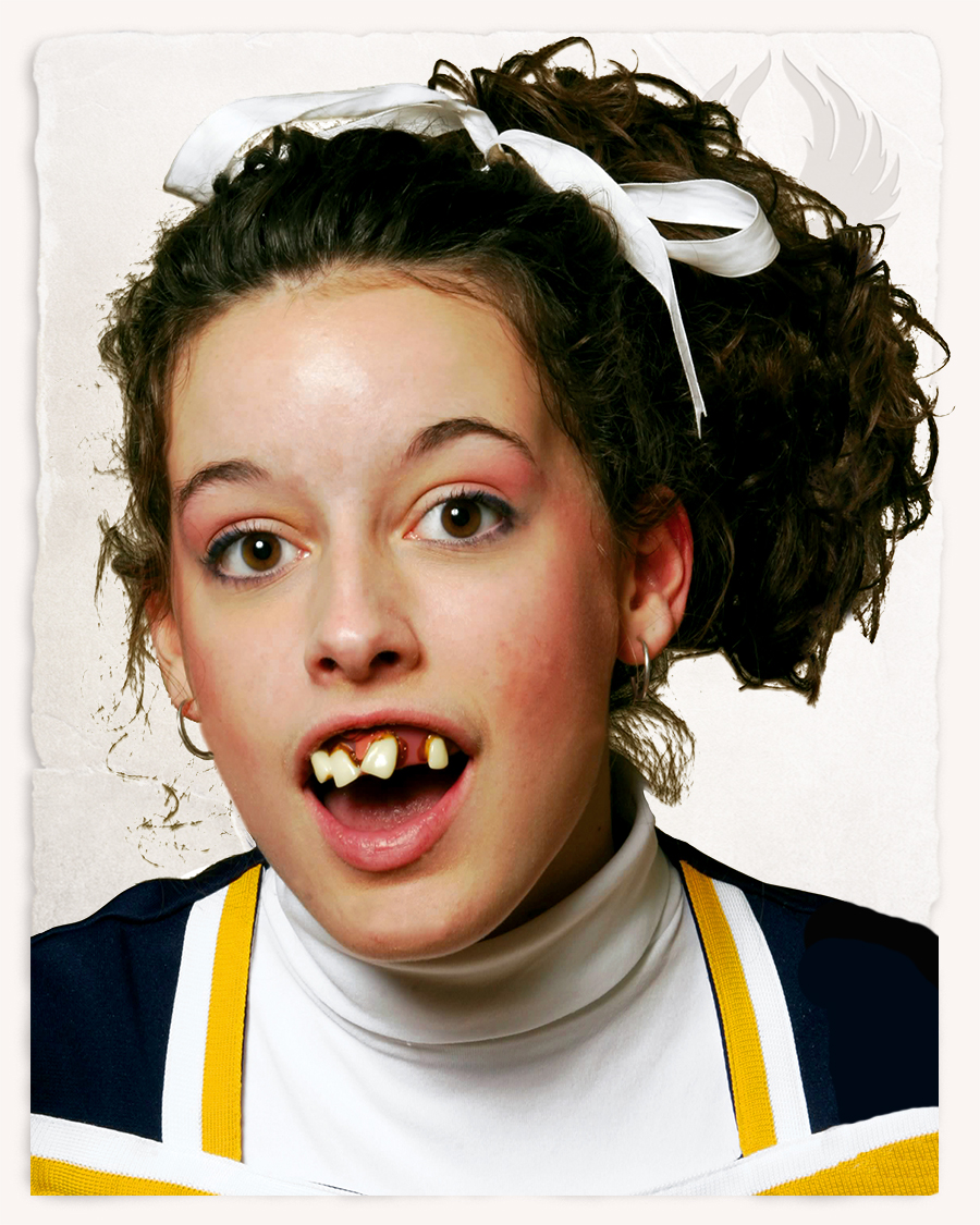 Cheerleader Zähne